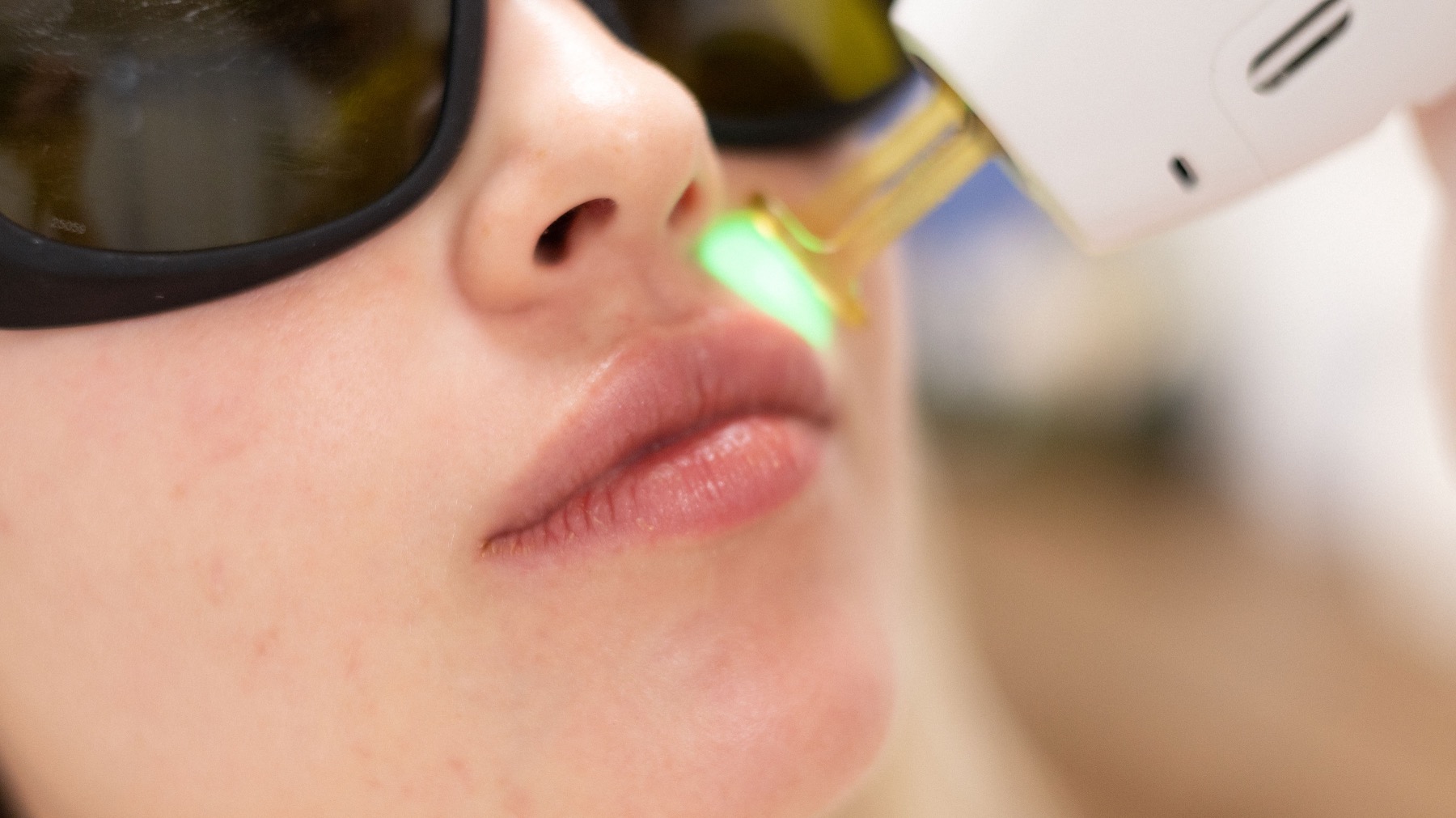 Laser Hair Removal Service New York NY